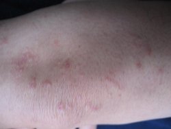 ������������ȷ����ţƤѢ