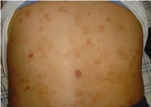 ������ɽƤ����ҽԺ��������	