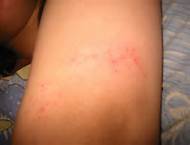 ������ɽƤ����ҽԺ���������	