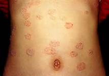 ����Ƥ����ҽ����ô��	