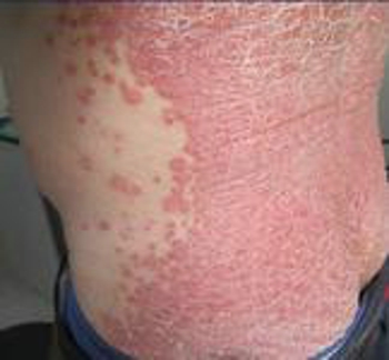 长春华山医院正不正规