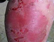 ������һҽԺƤ����Ȩ�����	